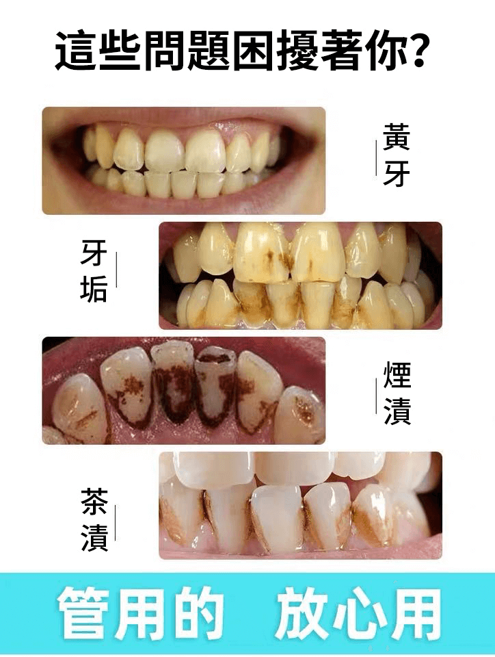 yayashi牙膏